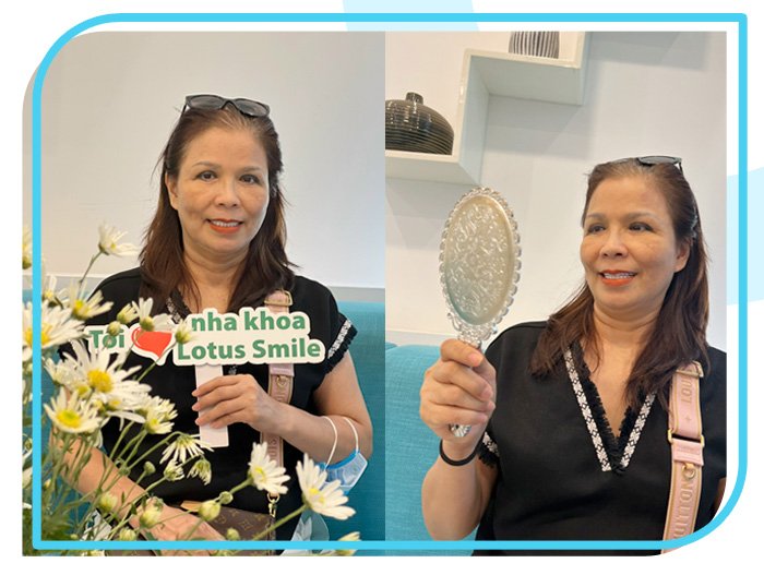 Răng sứ 16 Lotus-dental-hinh-anh-kh-11