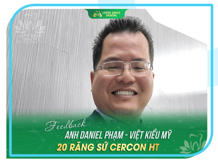 Răng sứ 12 Lotus-dental-hinh-anh-kh-8