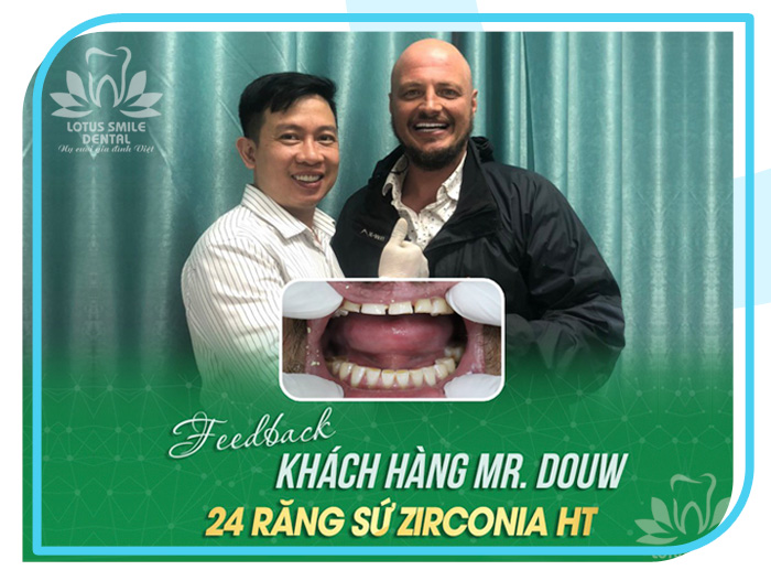 Răng sứ 14 Lotus-dental-hinh-anh-kh-9