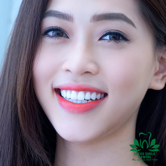 Về chúng tôi kh3