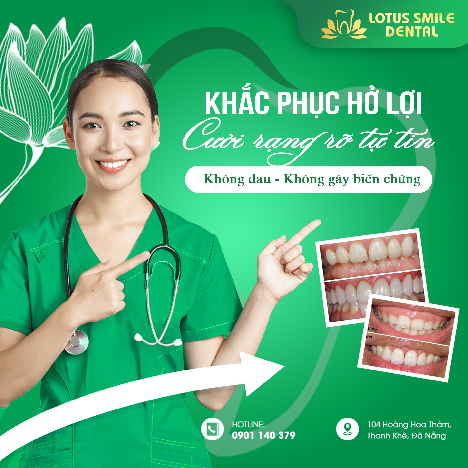 Niềng răng có ảnh hưởng gì không? Tiêu cực hay tích cực 289604466_575878514251256_1938306900060179530_n