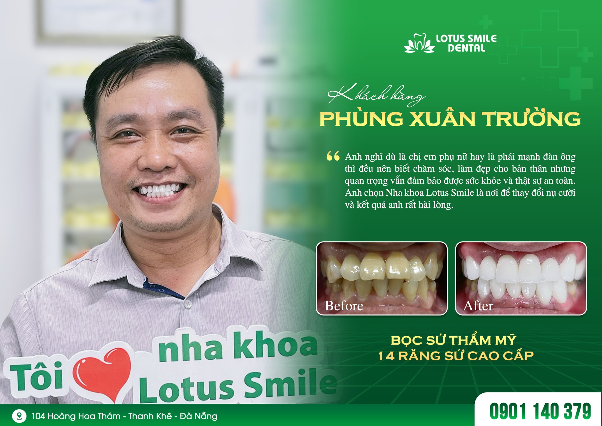 Địa chỉ bọc răng sứ ở Đà Nẵng uy tín. Mức giá chuẩn là bao nhiêu? 433137082_896669788922706_900062046316833142_n