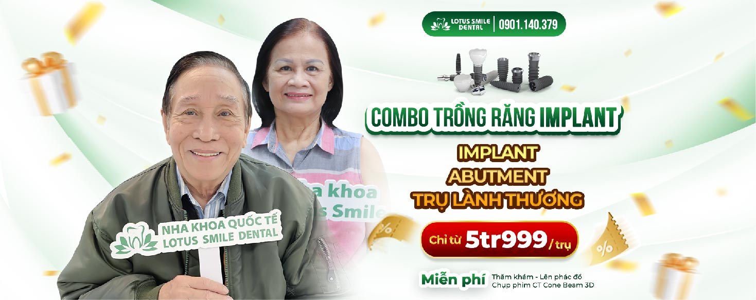 diia-chi-trong-rang-implant-uy-tin-tai-da-nang