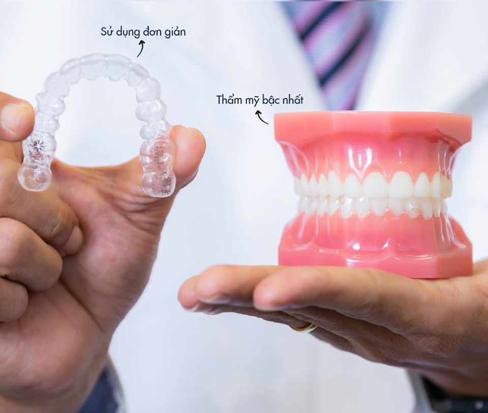 Niềng răng cho trẻ em có tốn kém không? Chi phí bao nhiêu? hinh-anh-gia-nieng-rang-invisalign-bao-nhieu-2