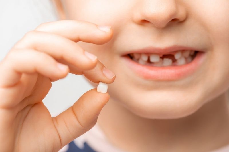 Răng trẻ em lung lay bao lâu thì nên nhổ? Cách nhổ răng lung lay không đau rang-tre-em-lung-lay-4