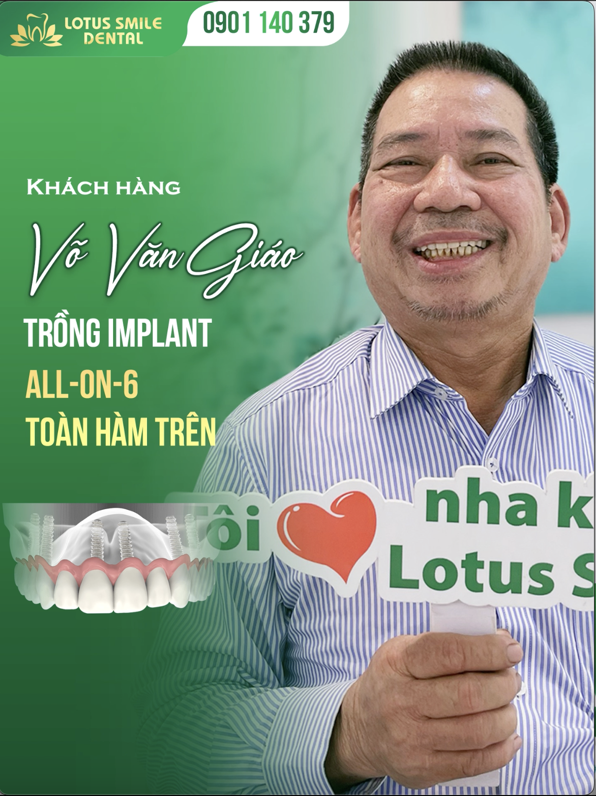 Trồng răng implant Đà Nẵng giá tốt nhất năm 2024 Screenshot2024-03-21at15.36.35