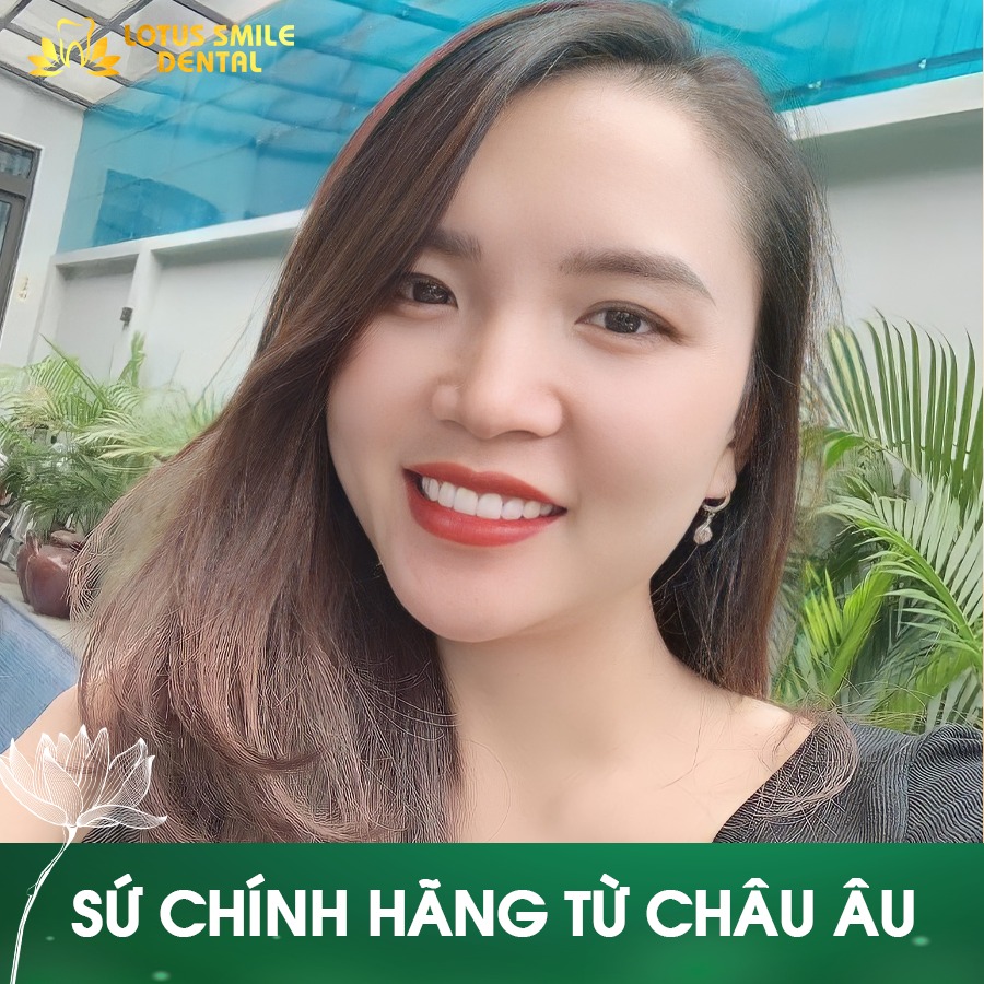 See how overseas Vietnamese review porcelain crowns to fix dental flaws. 291691907_584227586749682_2984566538320845090_n