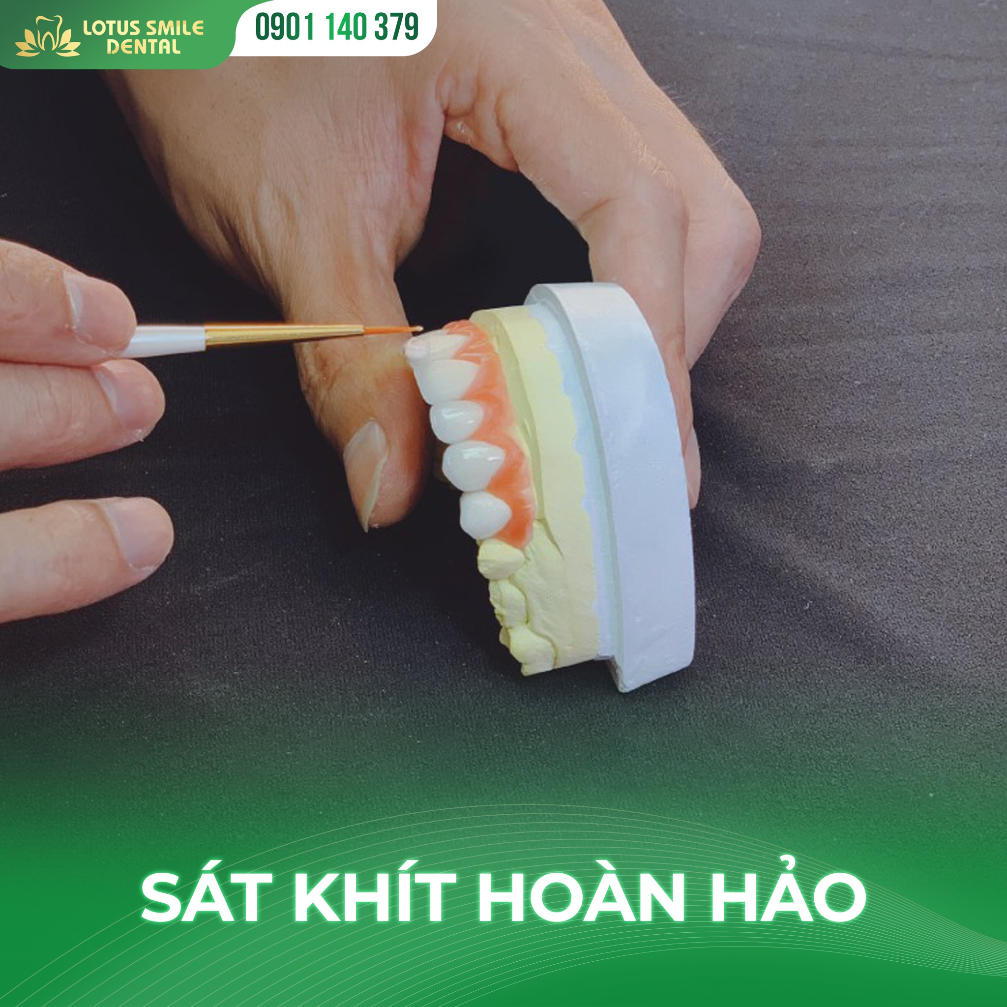 Có nên bọc răng sứ 2 răng cửa? Tất cả thông tin bạn cần biết. bọcrăngsứ3