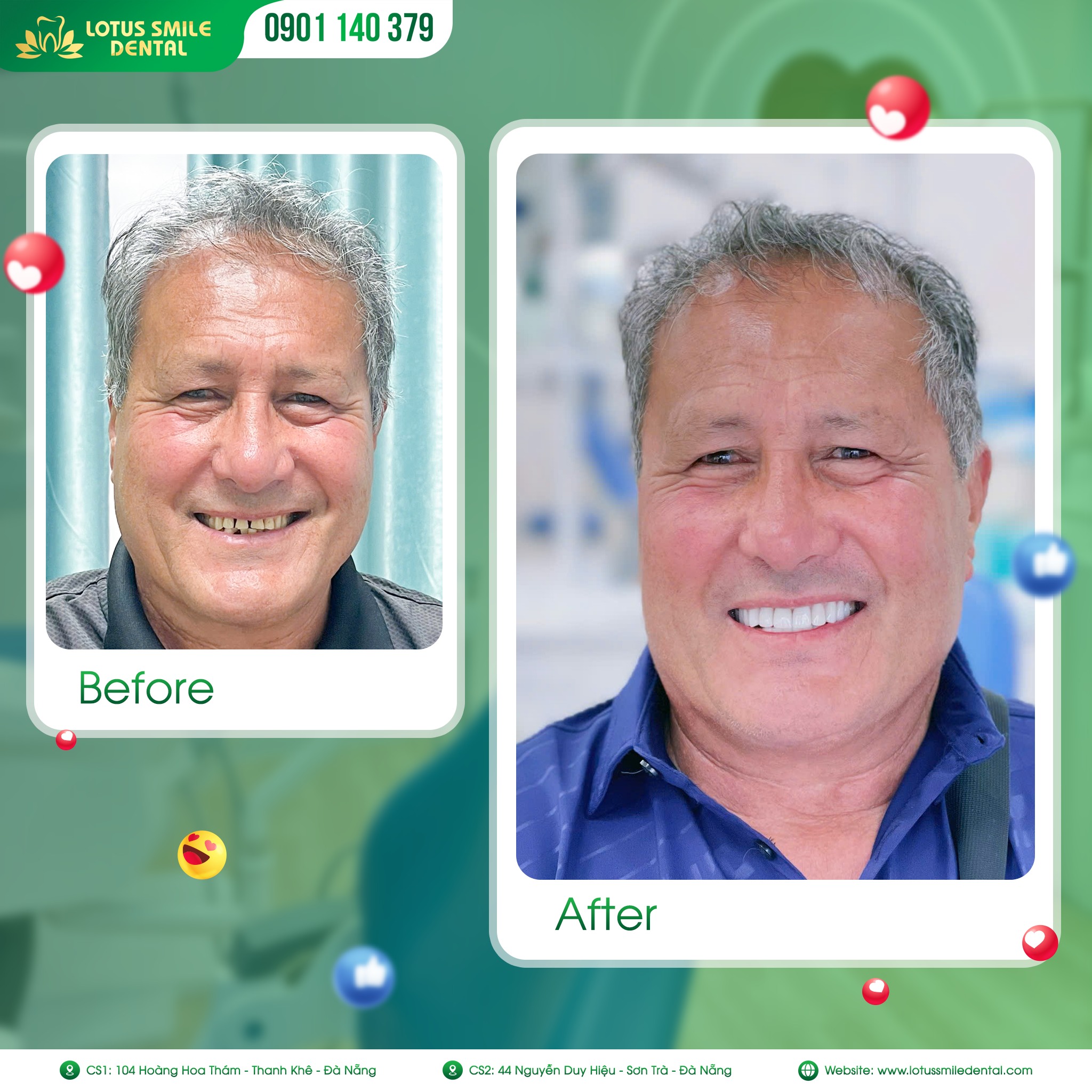 Dánsứveneernướcngoàitm1