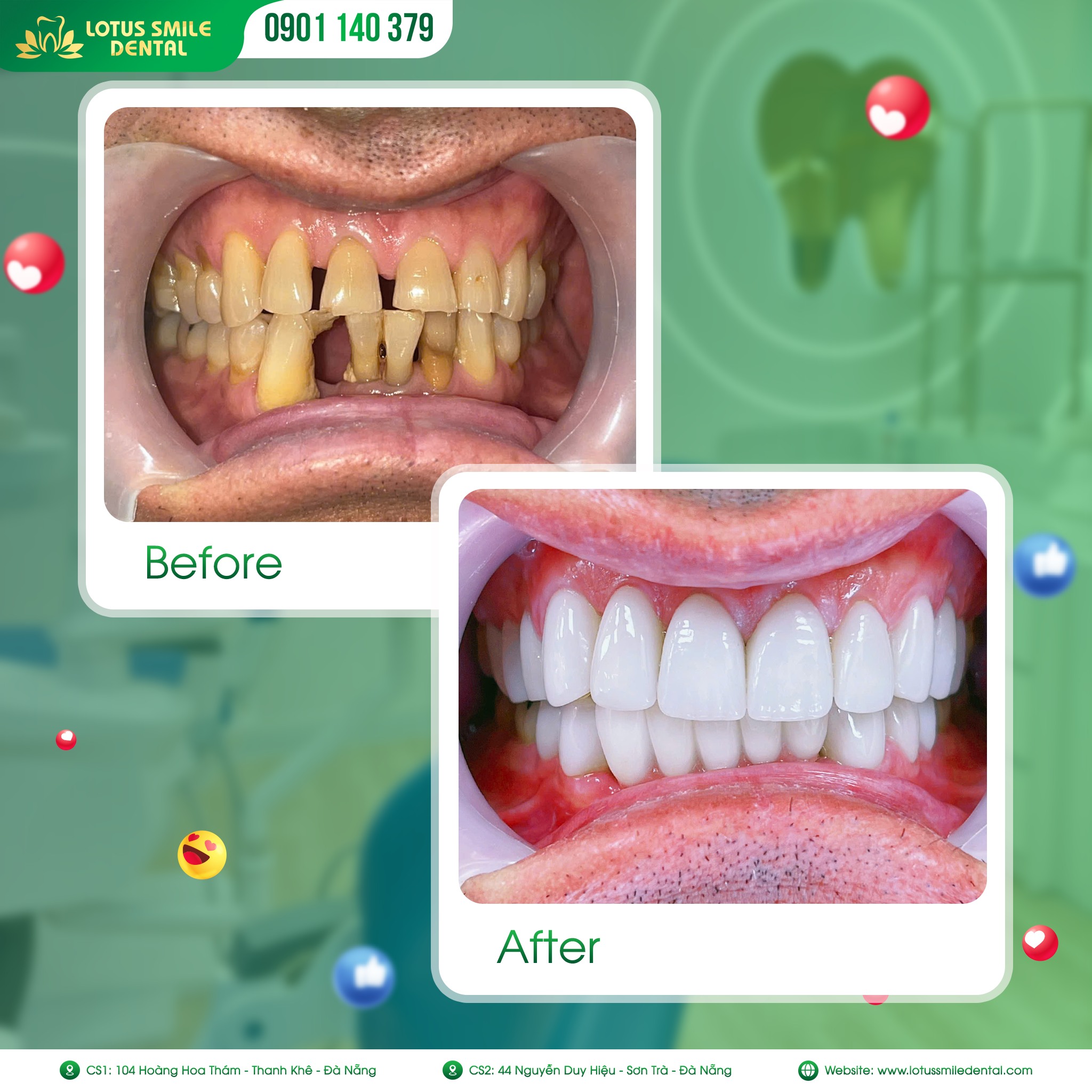 Dánsứveneernướcngoàitm2