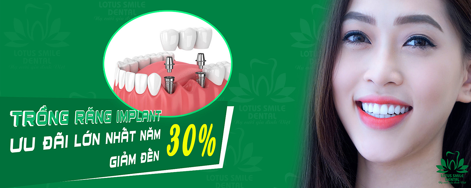 Lotus Smile Dental - Nha Khoa Quốc Tế Lotus Smile