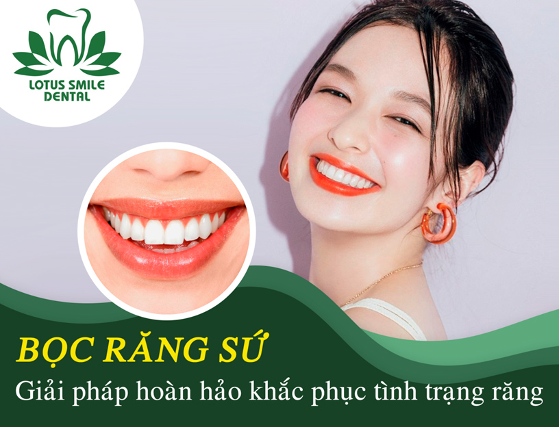 Bọc răng sứ chính hãng tại trung tâm nha khoa hiện đại bậc nhất đà nẵng – Ưu đãi 50% - Bảo hành 15 năm boc-rang-su-lotus-smile-dental