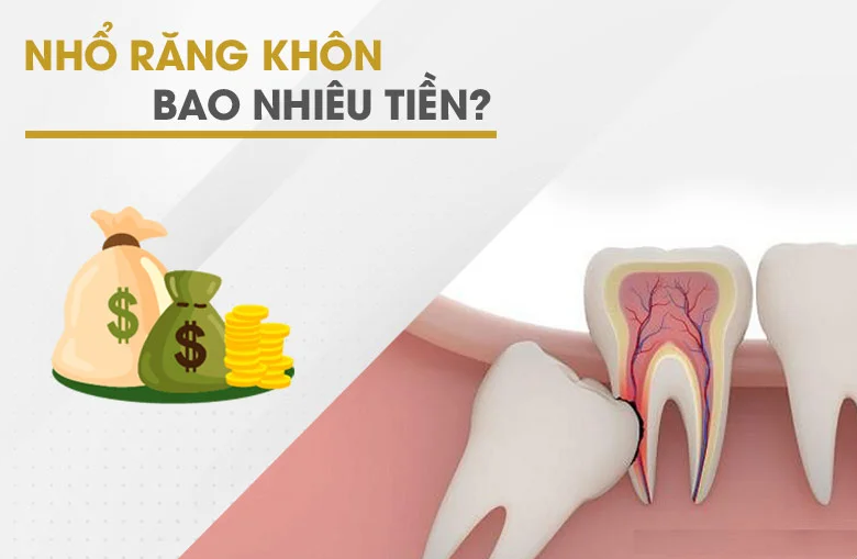 Chi Phí Nhổ Răng Số 8 Bao Nhiêu Tiền? nho-rang-khon-bao-nhieu-tien-1