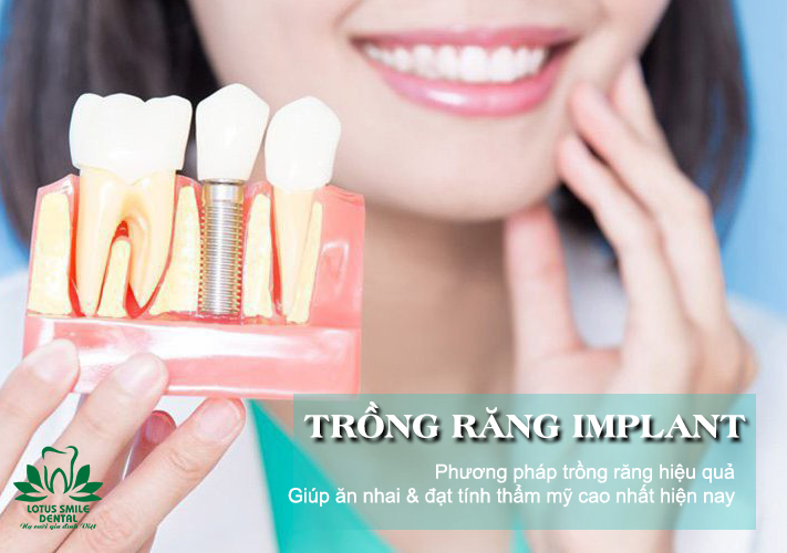 Những hậu quả khó lường khi trồng răng implant giá rẻ implanttrồngrăng