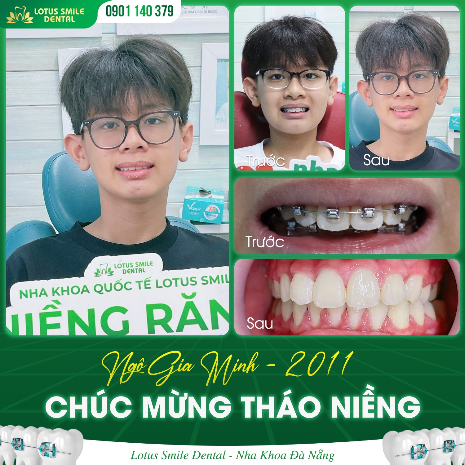 Niềngrằng1