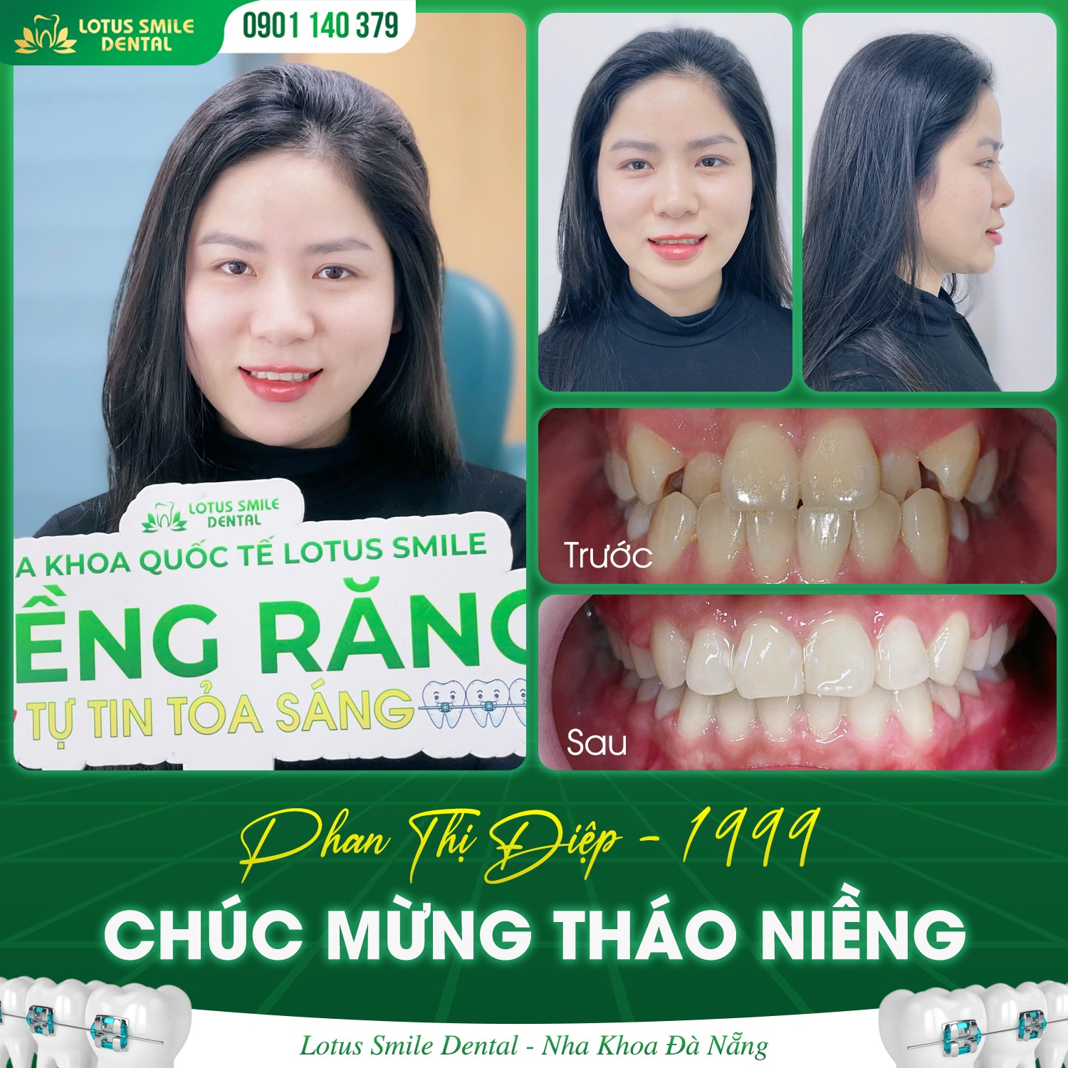 Niềngrăng1999