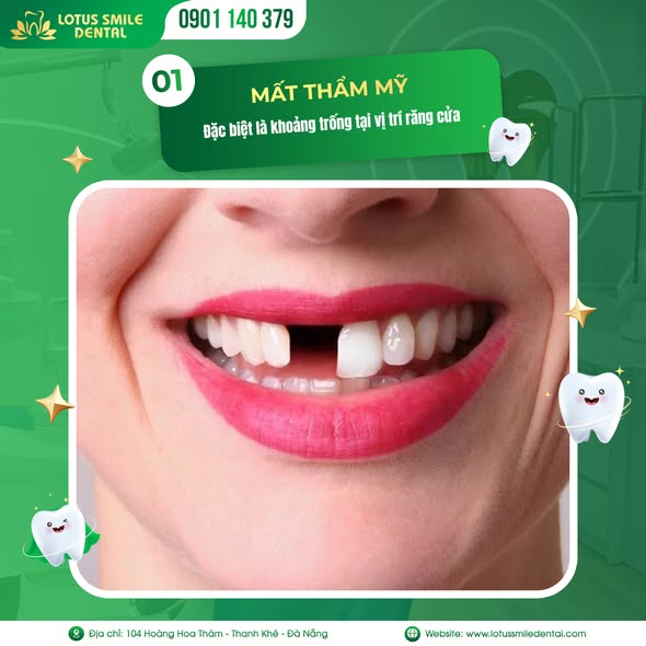 Mất1răng