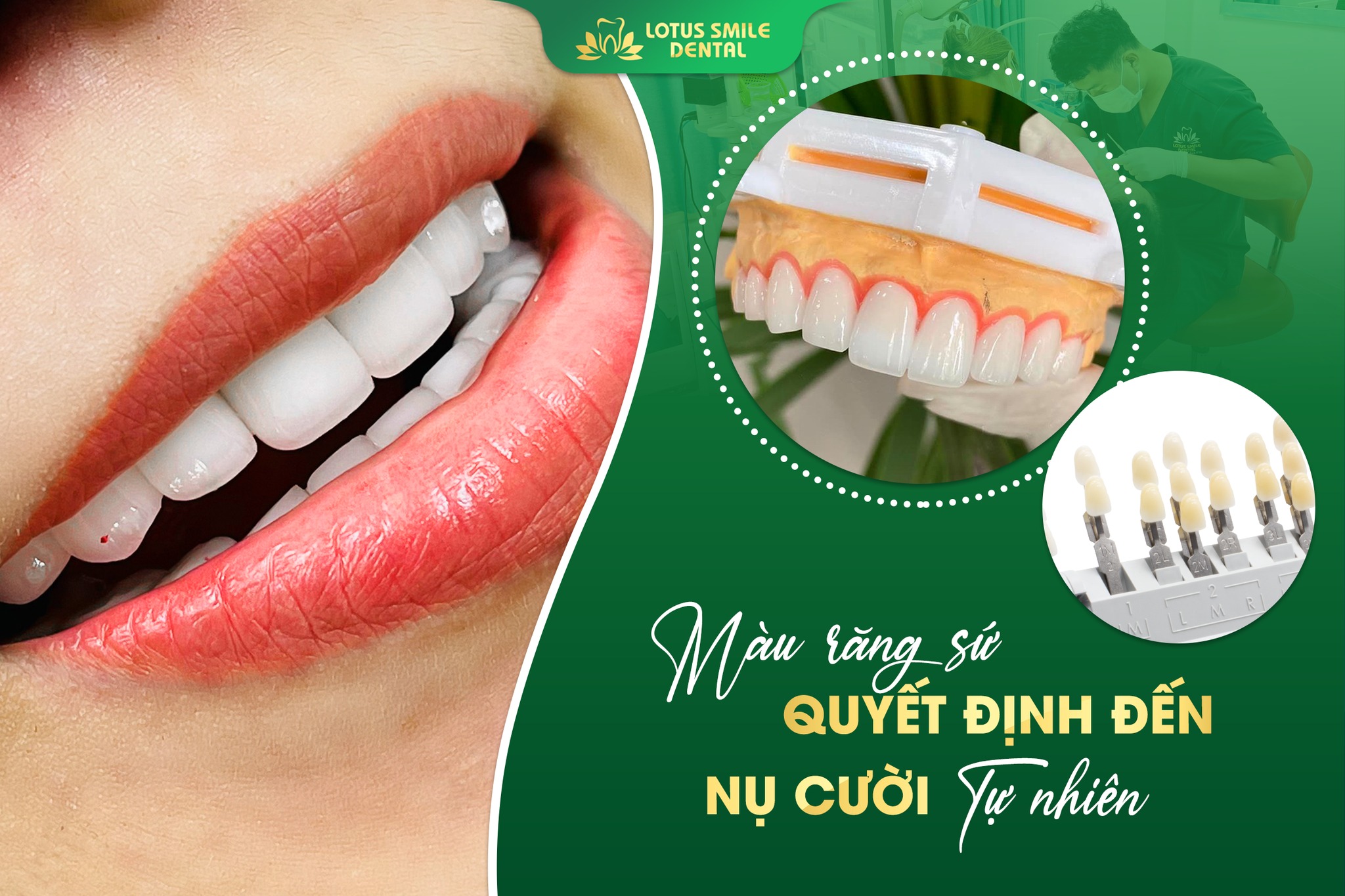 Tìm địa chỉ bọc răng sứ uy tín và chất lượng cao tại Đà Nẵng 336672874_871202890607717_8805508197212635450_n