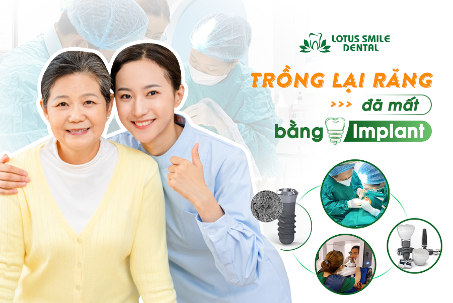 Tại Sao Cô Chú Việt Kiều Lựa Chọn Đà Nẵng Để Trồng Răng Implant? implant