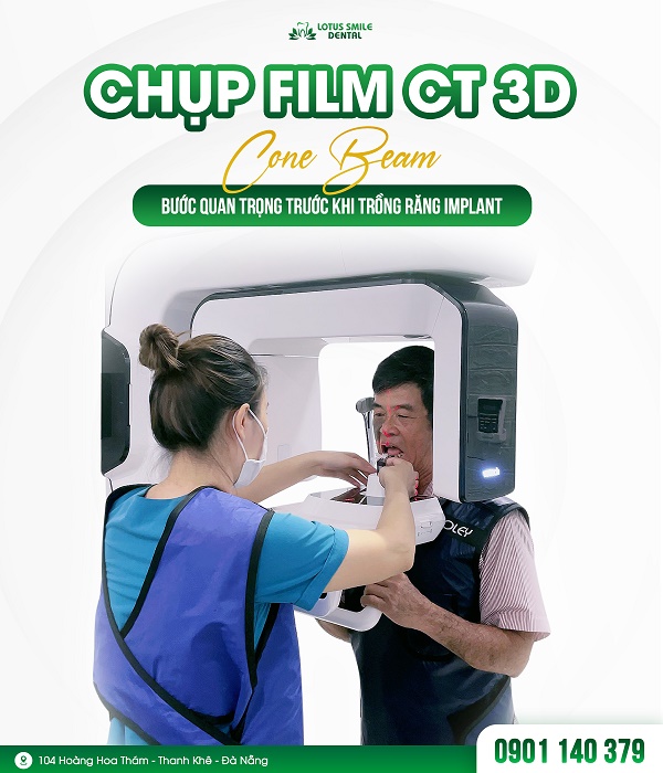 SCHEDULE A CONE BEAM CT SCAN, GET A FREE PLAN FROM AN EXPERT