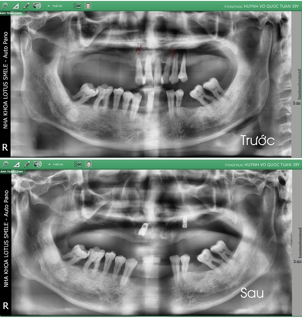 ct-khach-huynh-vo-quoc-tuan