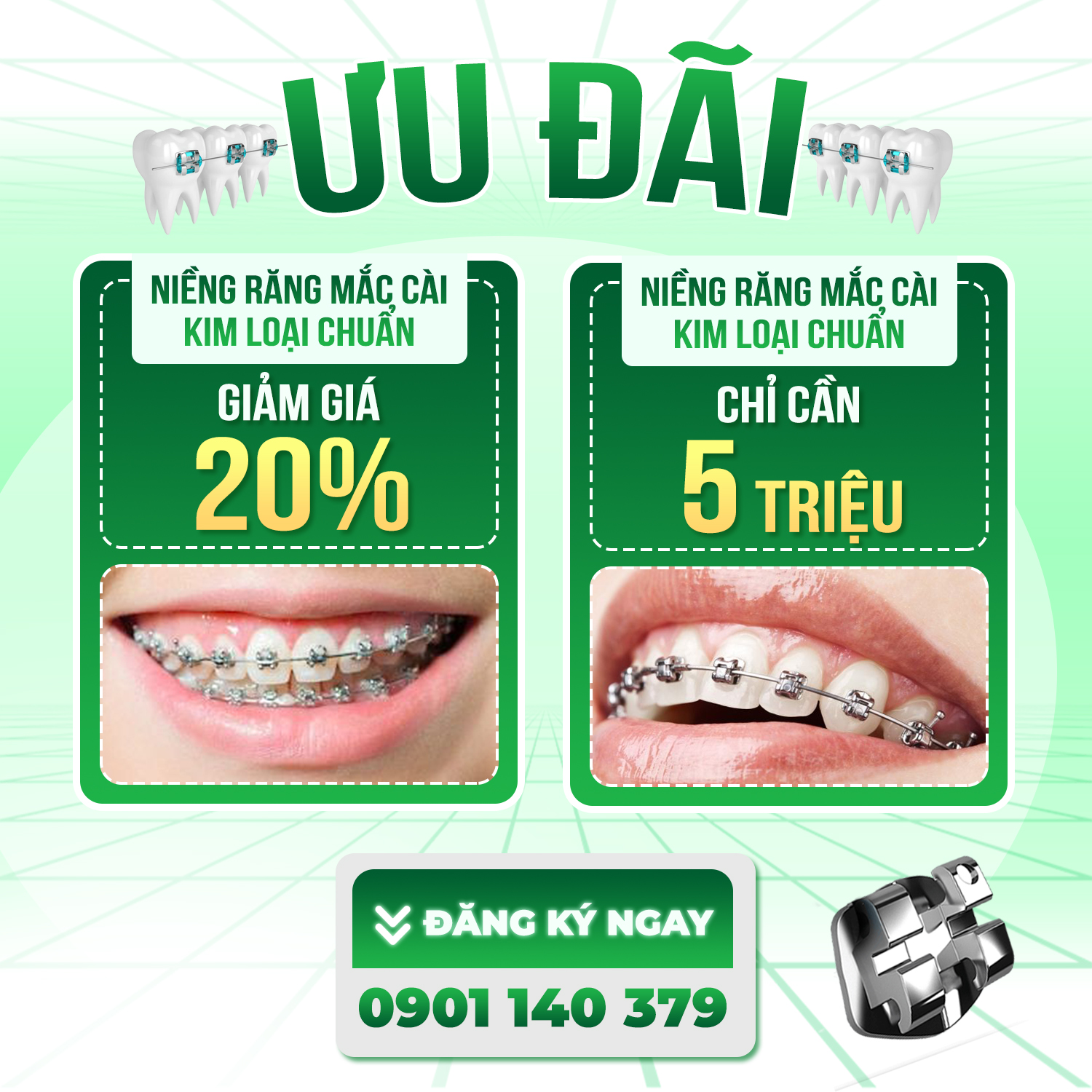 Review Trải Nghiệm Niềng Răng Thẩm Mỹ Tại Nha Khoa Lotus Smile 2