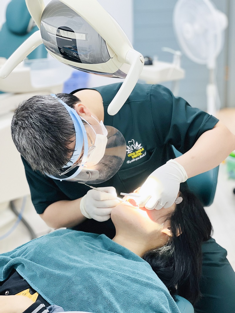 Missing 2 front teeth - which dental implant method is good? bs-1