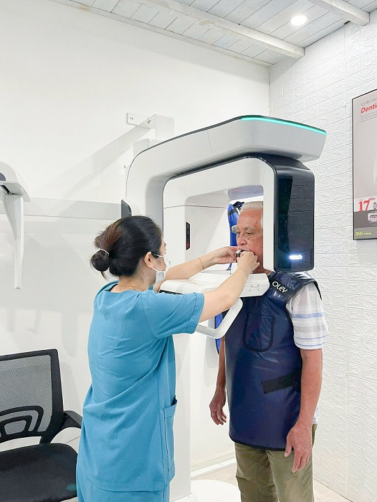 Giả đáp Trồng răng IMPLANT có sử dụng được vĩnh viễn không! ct-cone-beam-web-1