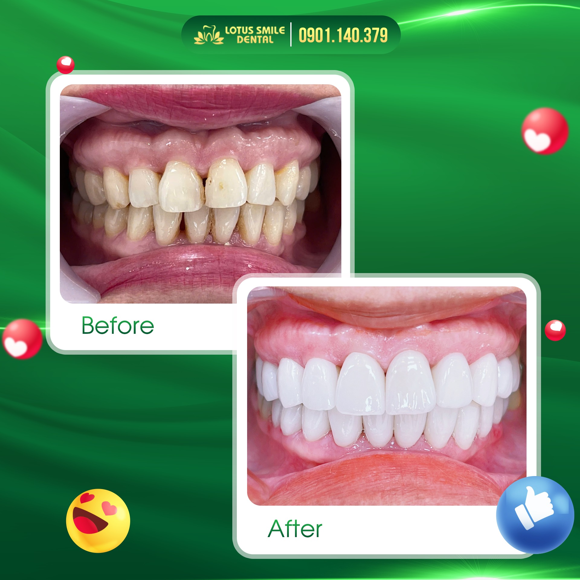 574322487_794539213423068_6261546653422442445_n