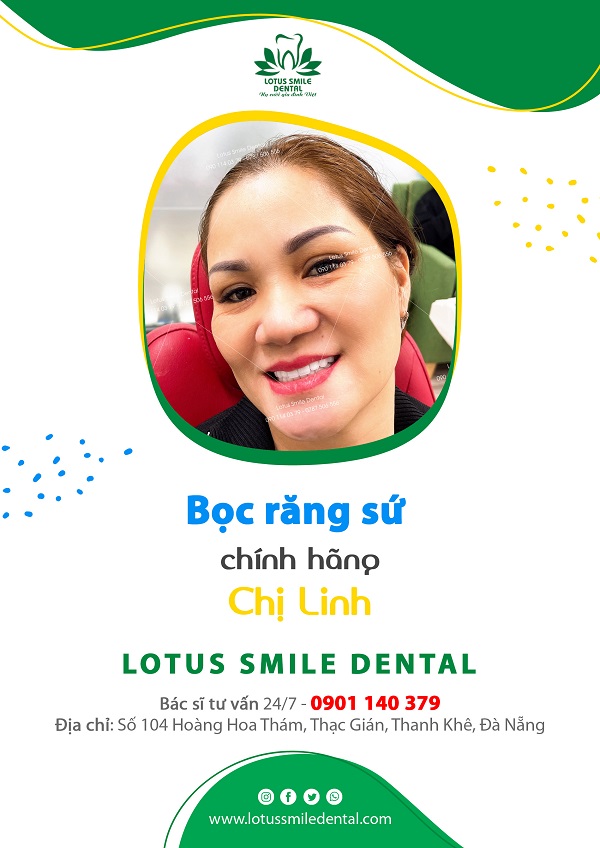 Răng sứ Cercon HT có những đặc điểm vượt trội nào so với những dòng răng sứ khác kh-chi-linh-600px