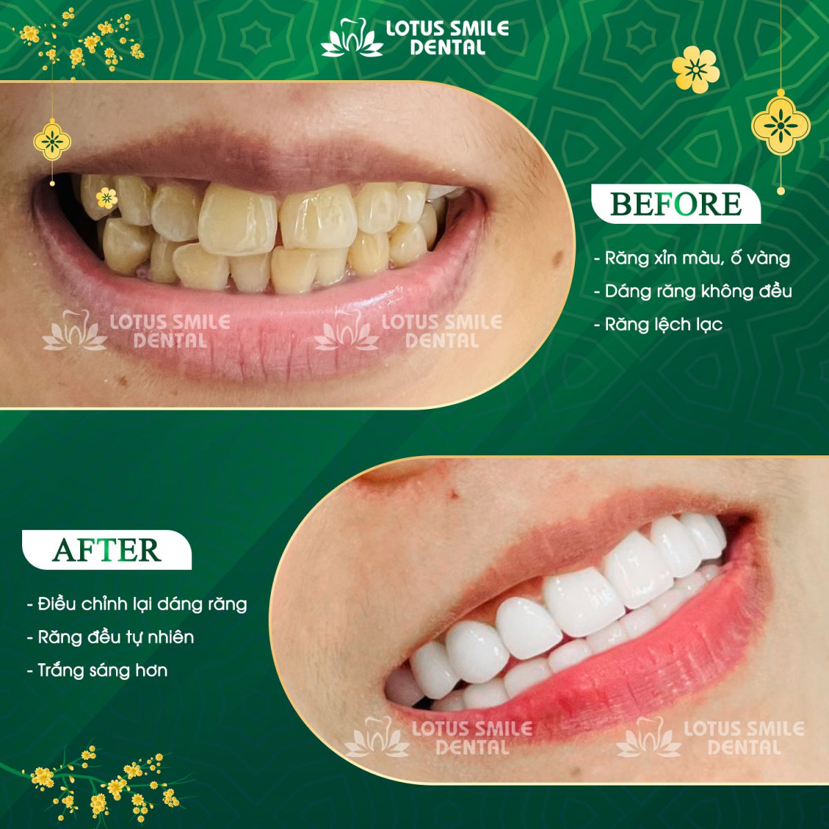 78Win Dental - Nụ Cười Rạng Rỡ, Tự Tin Tỏa Sáng Với https//78win.dental/