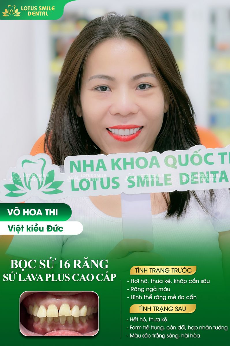 78Win Dental - Nụ Cười Rạng Rỡ, Tự Tin Tỏa Sáng Với https//78win.dental/ - Hình 1